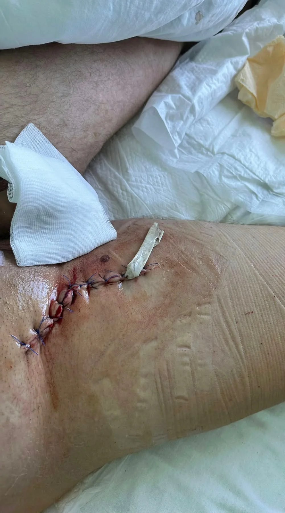 Sensitive medical recovery photograph